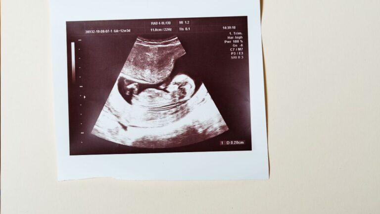 MO Senate Opens Door To Replace Radical Abortion Amendment
